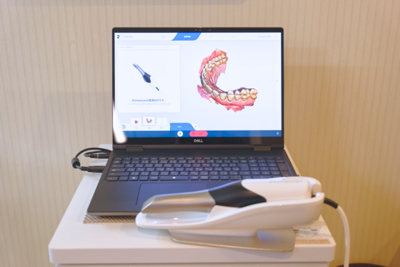 精密な型取り|大倉歯科