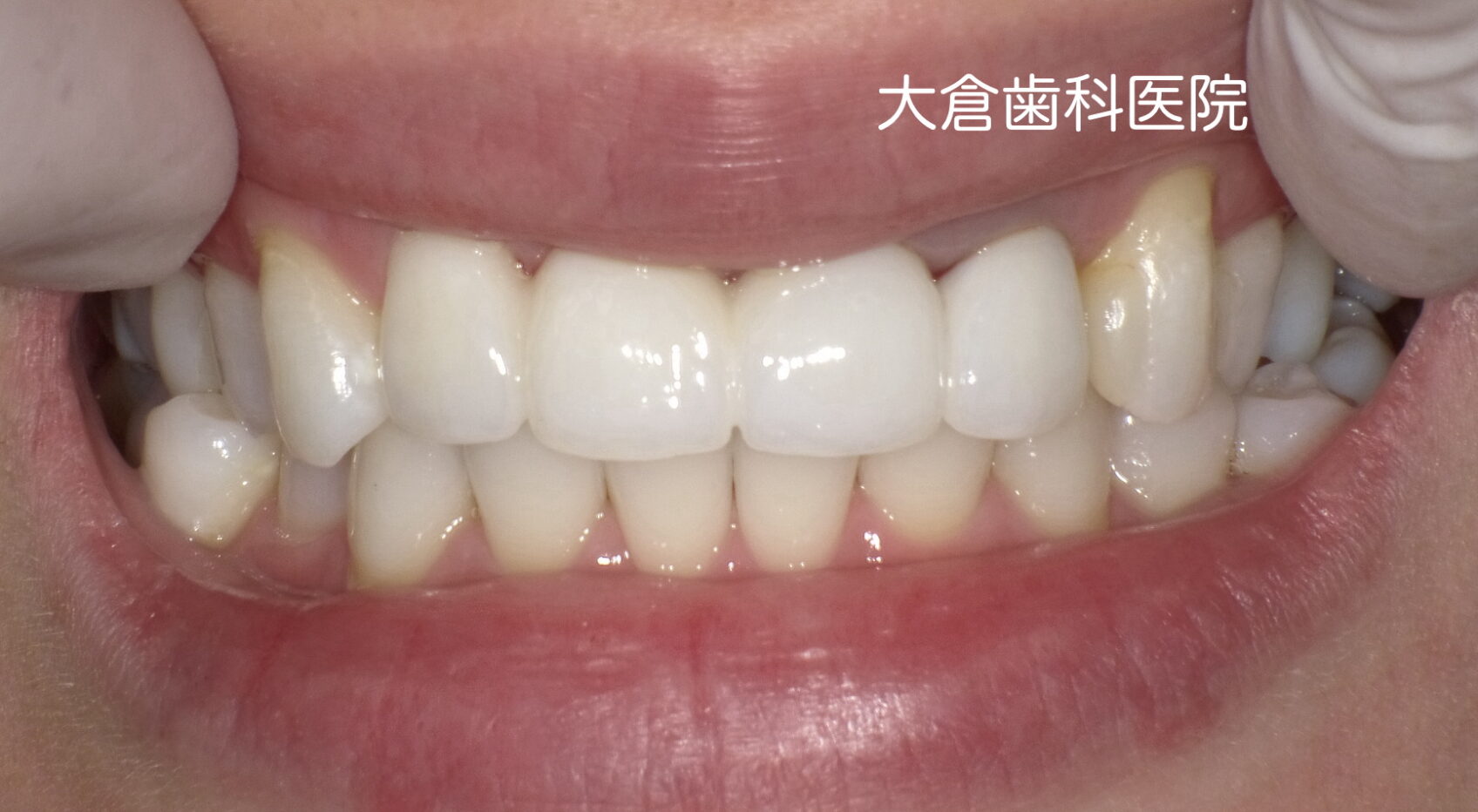 香芝　五位堂　歯医者
