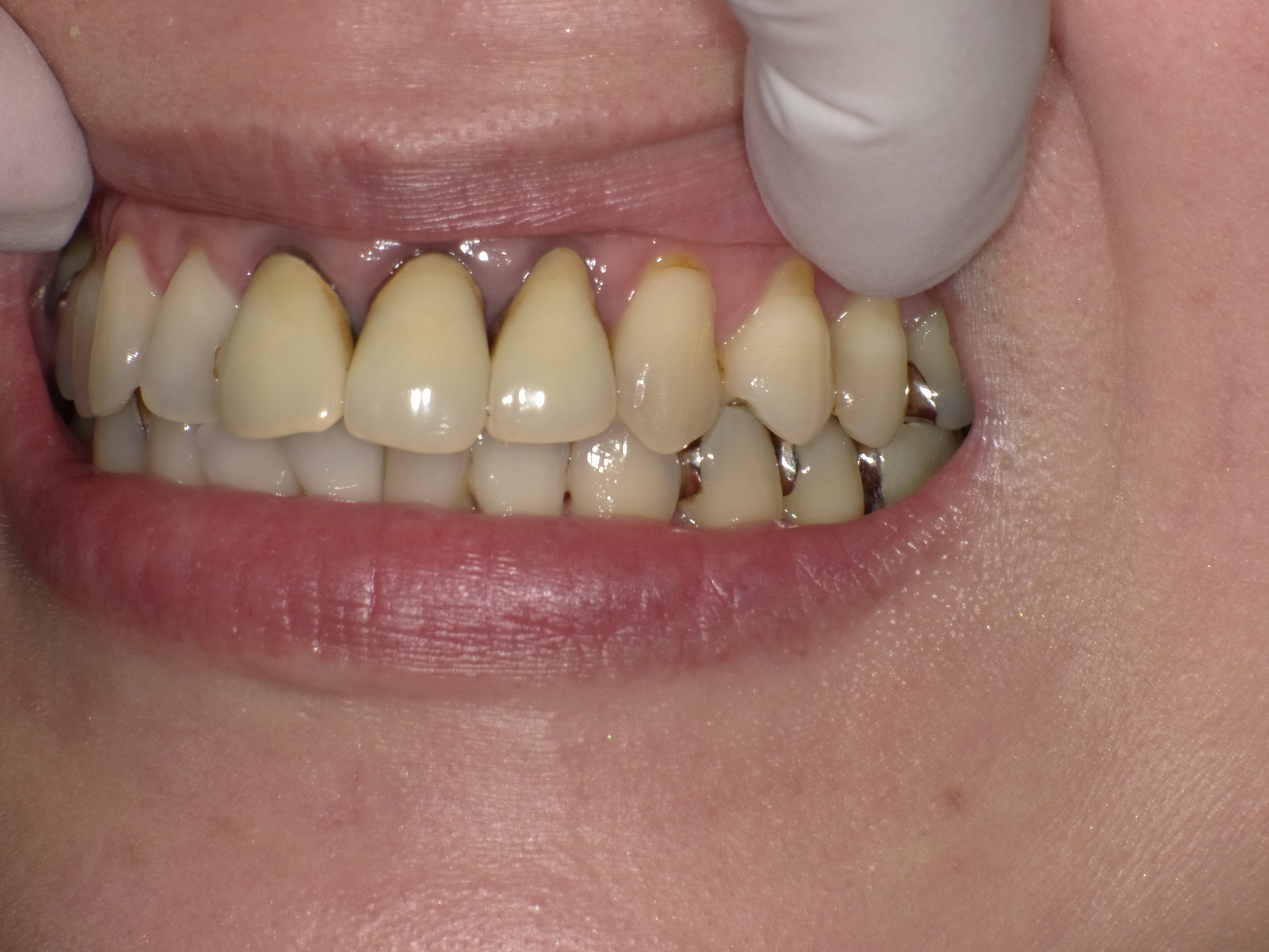 SHOFU DENTAL DIGITAL CAMERA